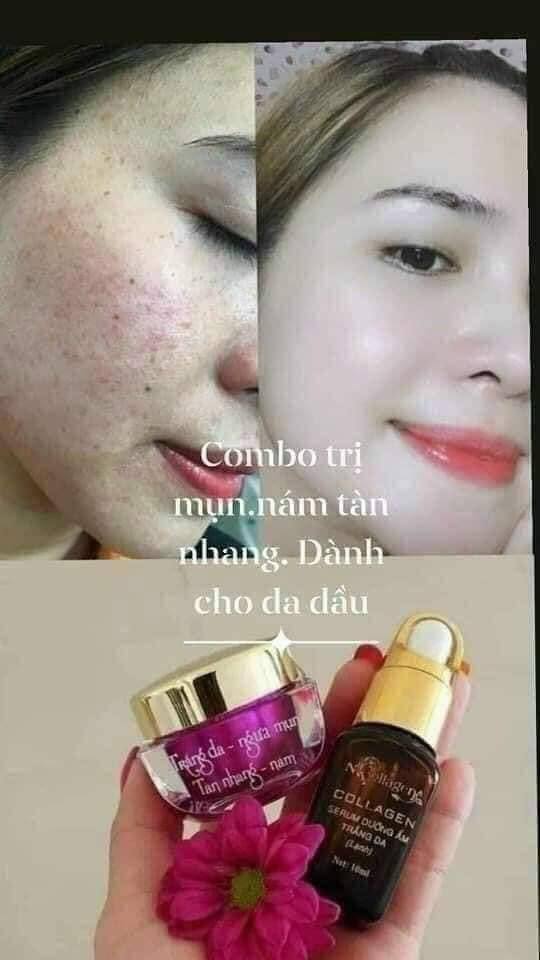 Dưỡng trắng da với kem face tím NCollagen và Serum cao cấp NCollagen